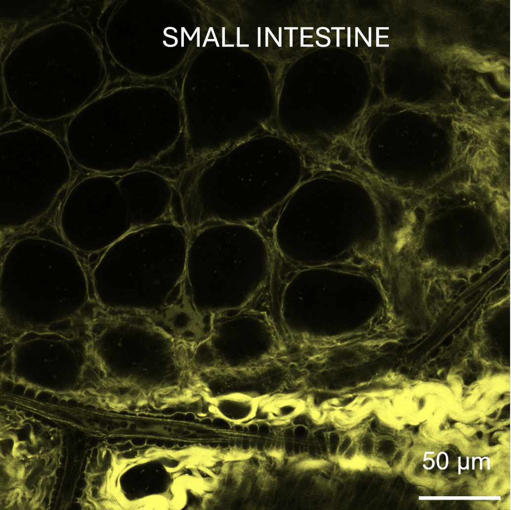 Use of Rhobo6 ECM Dye for labeling the extracellular matrix (ECM) in live small intestine tissues.